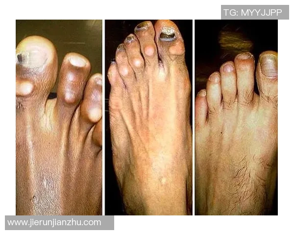 从足球球星脚趾看力量与技巧的秘密揭示运动巅峰背后的微小细节